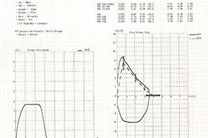 نمونه تست SPIROMETER