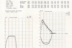 نمونه تست SPIROMETER