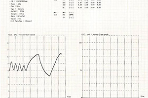 نمونه تست SPIROMETER